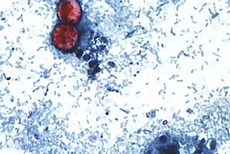 Johnson County Cyclosporiasis parasite